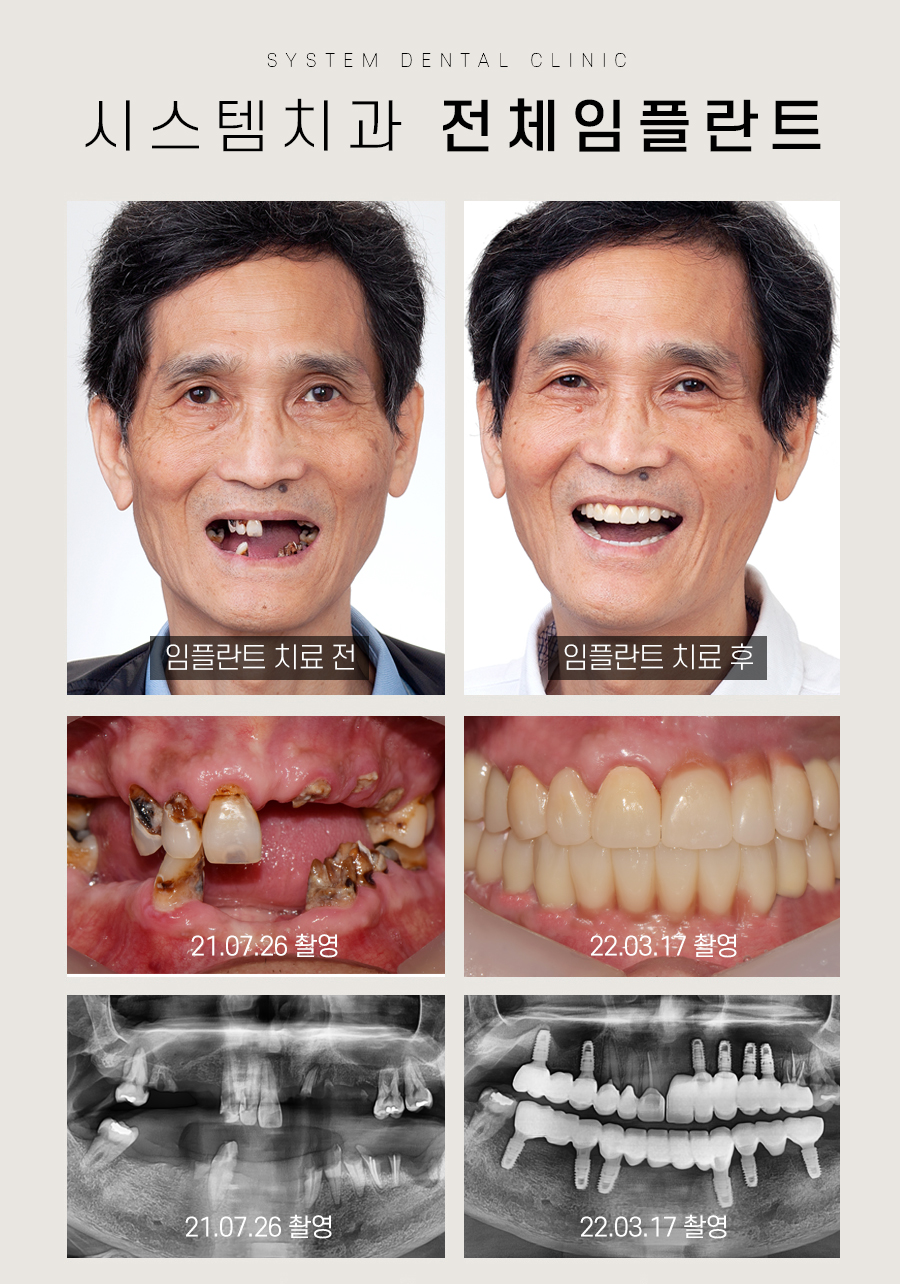 시스템치과의원 명동 대표 이미지