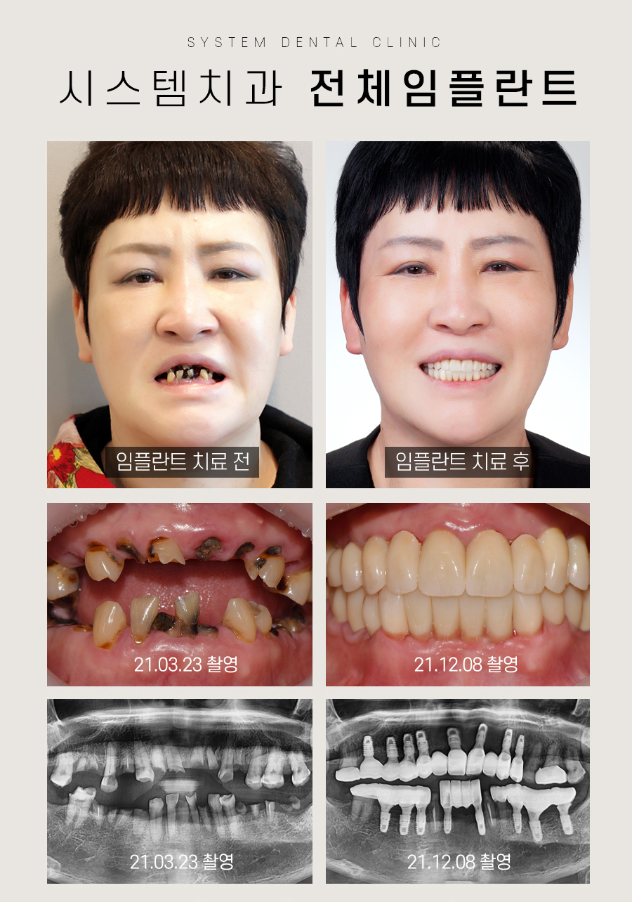시스템치과의원 명동 대표 이미지