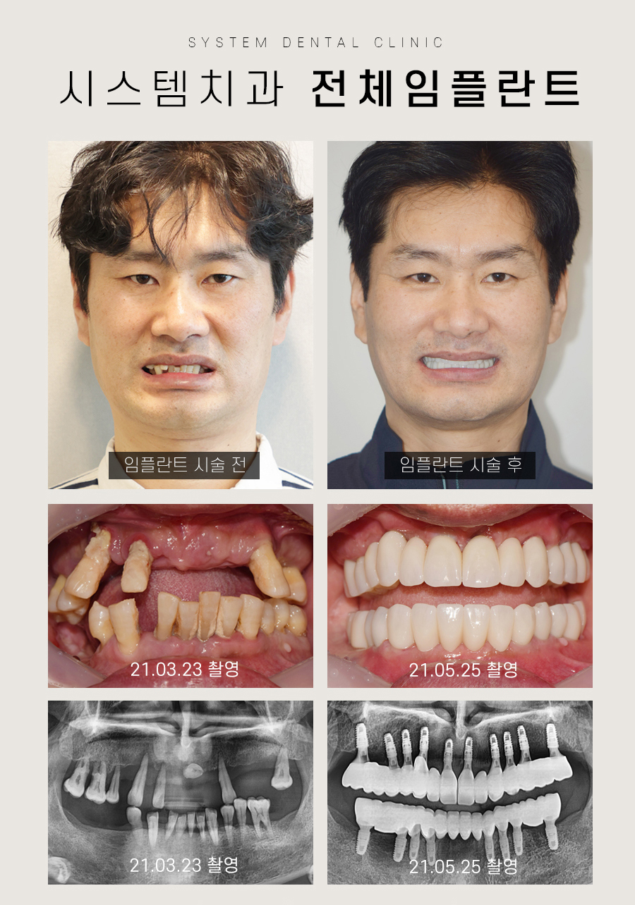 시스템치과의원 명동 대표 이미지