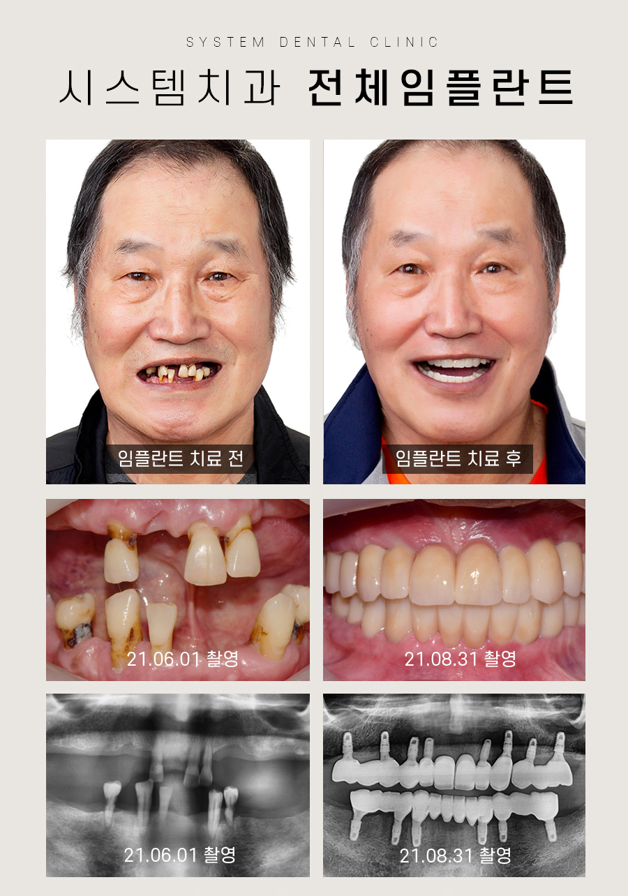 시스템치과의원 대표 이미지