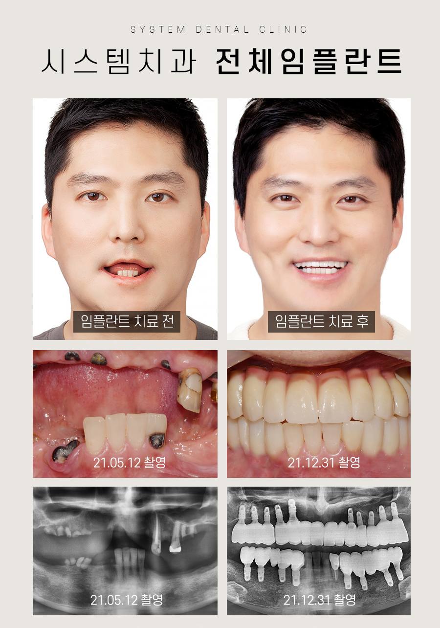 시스템치과의원 명동 대표 이미지