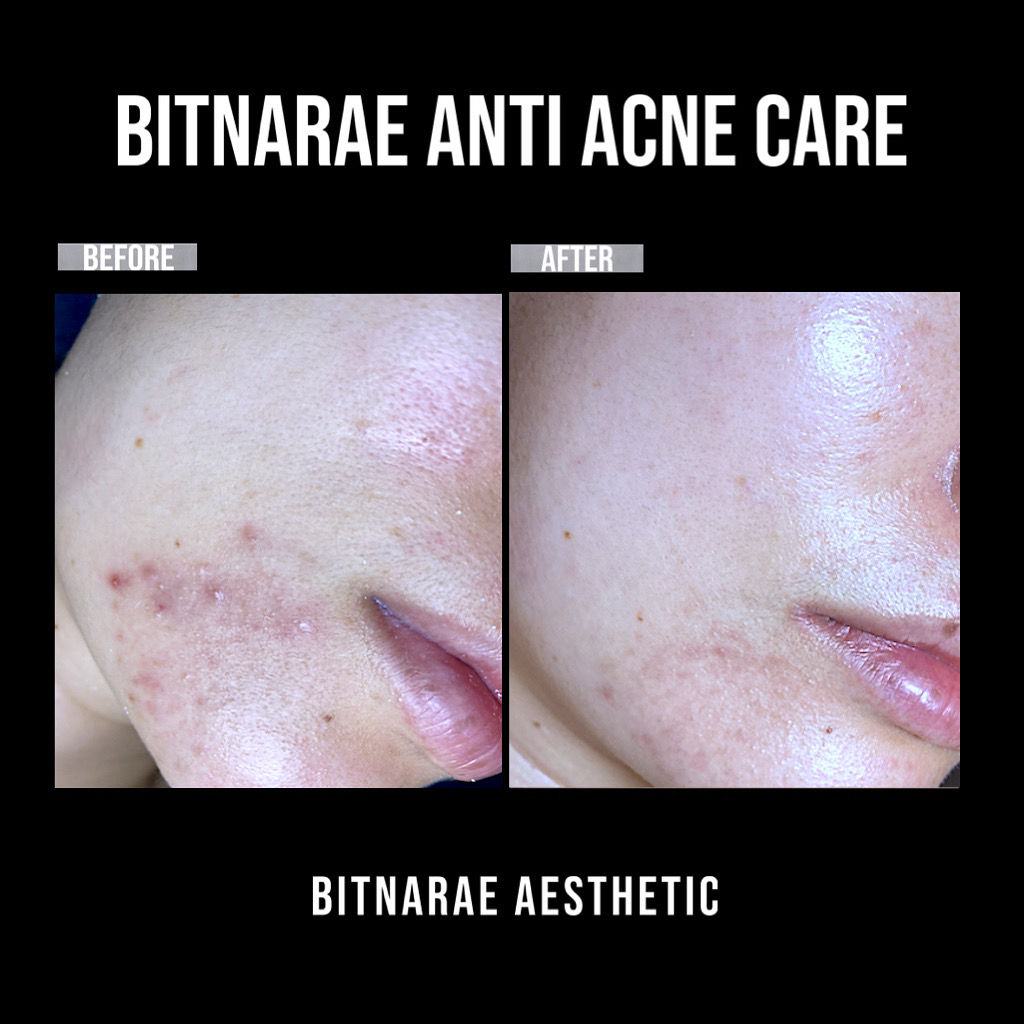 빛나래에스테틱 강남본점 대표 이미지