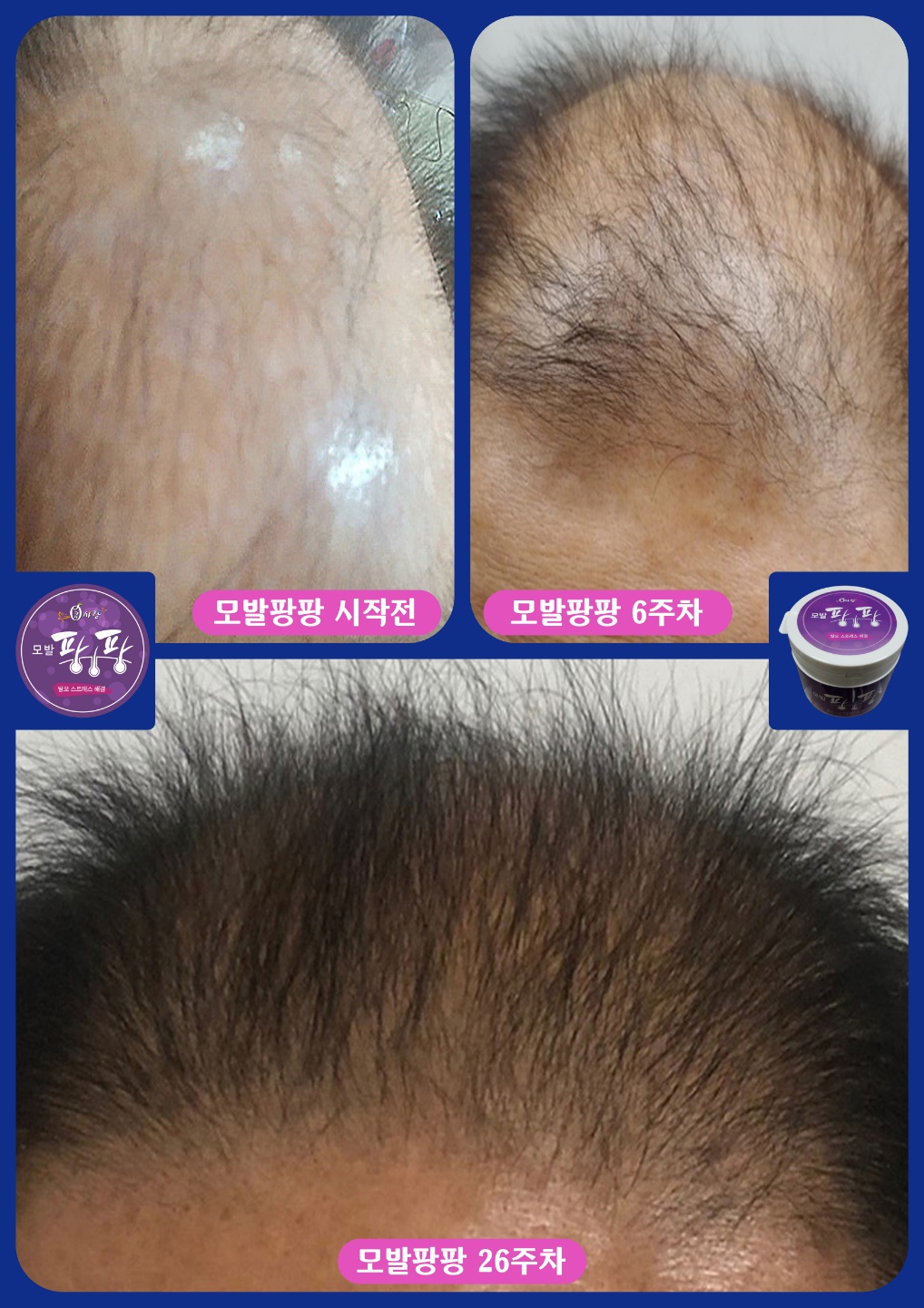 큐사랑 홍천점 대표 이미지