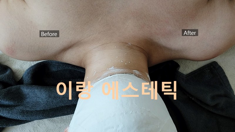 이랑에스테틱 대표 이미지