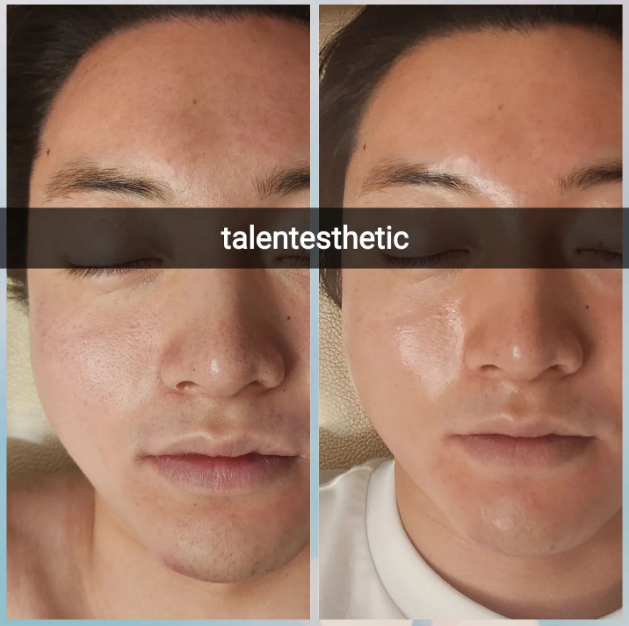 탤런트에스테틱 대표 이미지