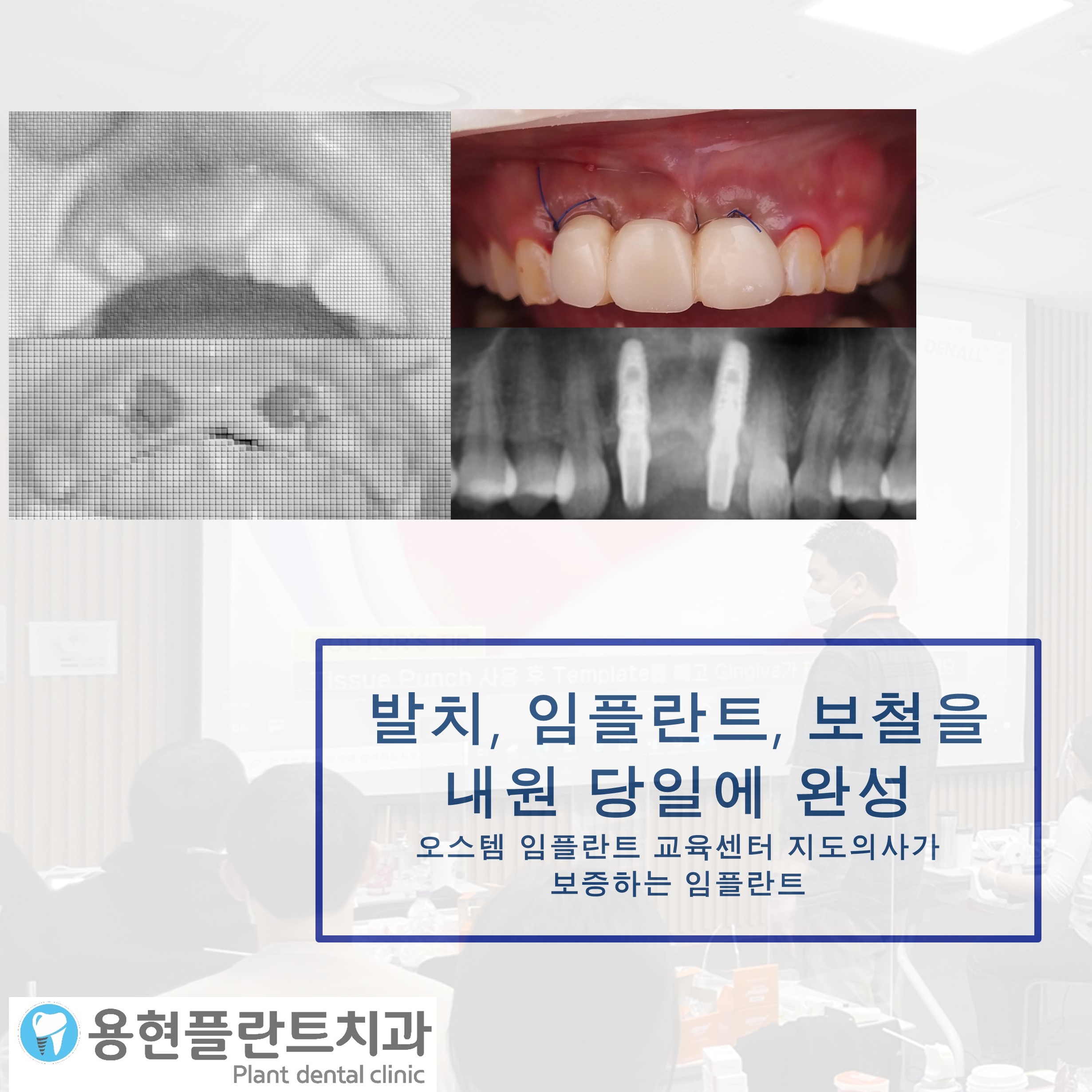 플란트구강악안면외과치과의원 대표 이미지
