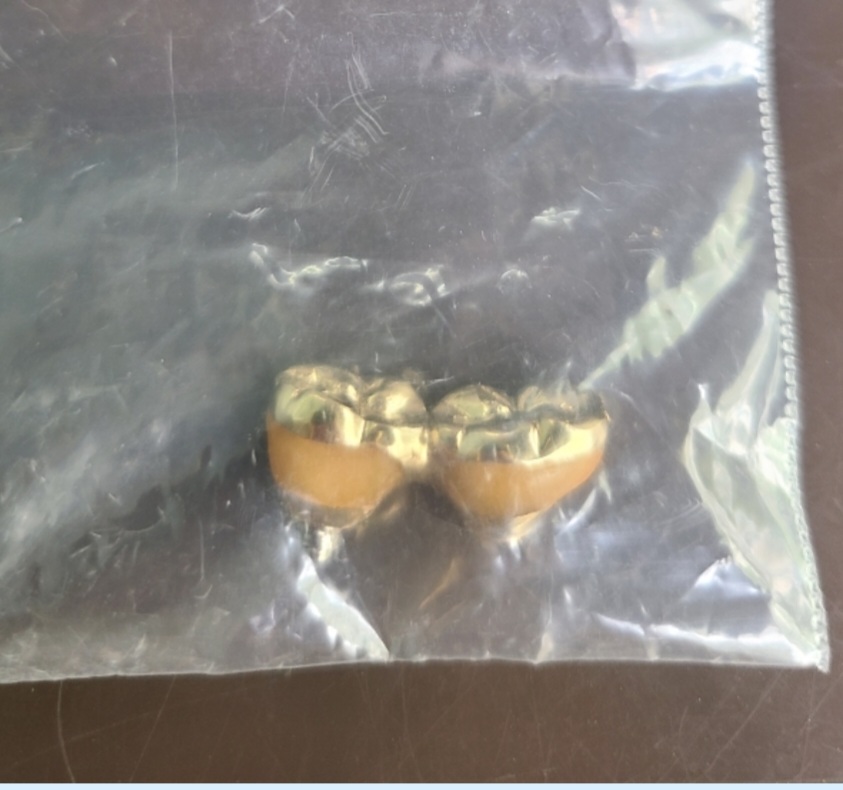 덴포유 금니거래소