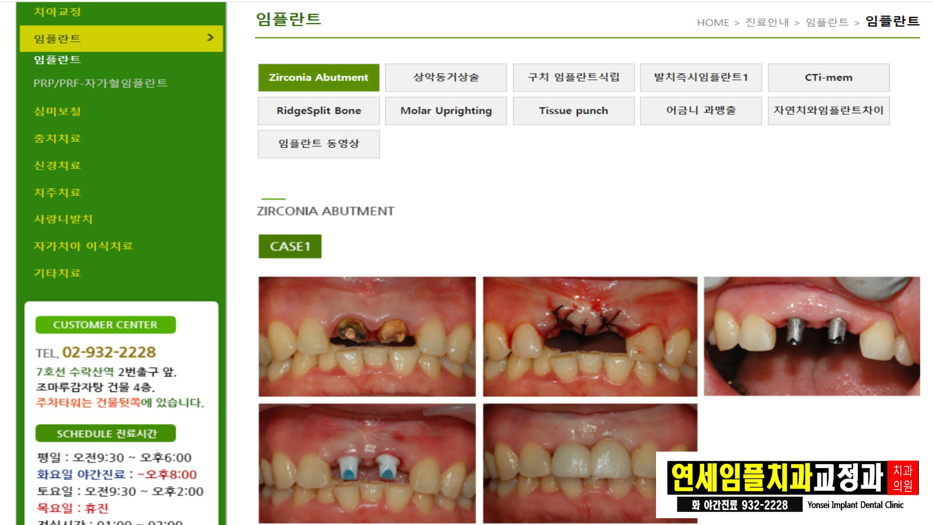 연세임플치과교정과치과의원 대표 이미지