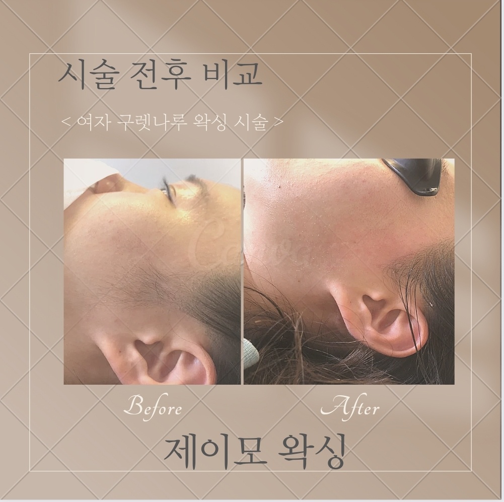 제이모왁싱 수원광교점