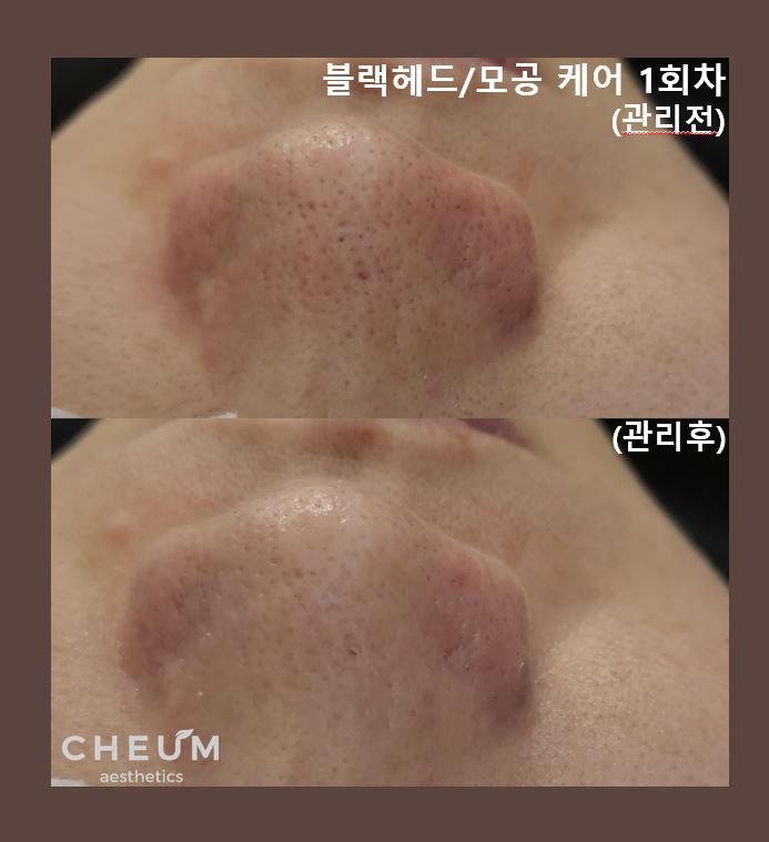 채움에스테틱