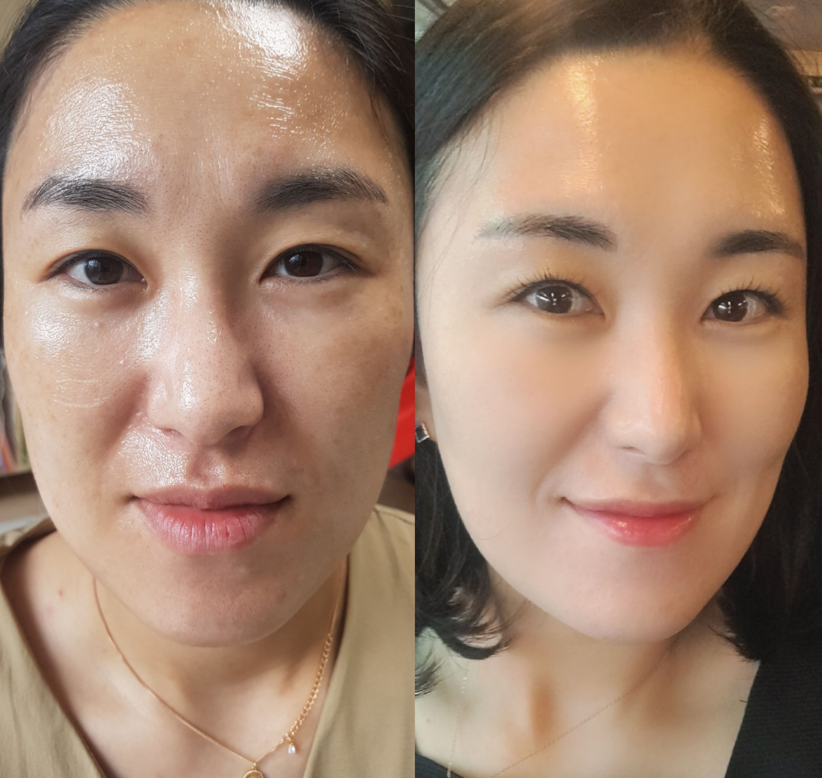 인셀덤 B&B목포대리점