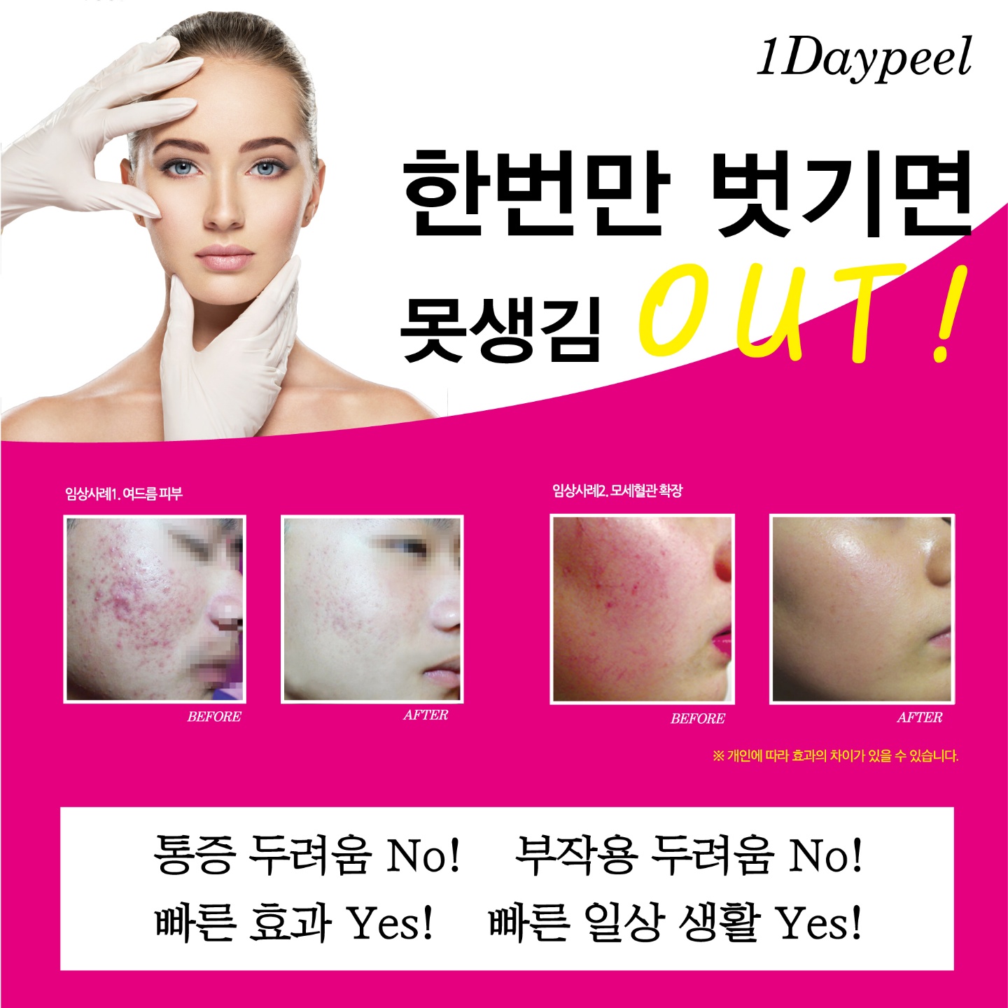 채움에스테틱