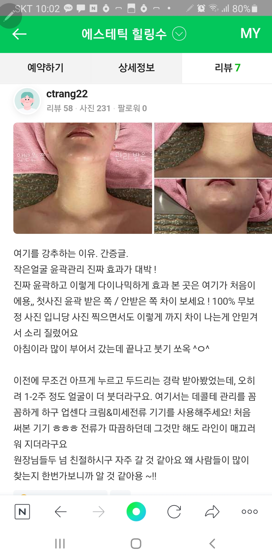 에스테틱 힐링수