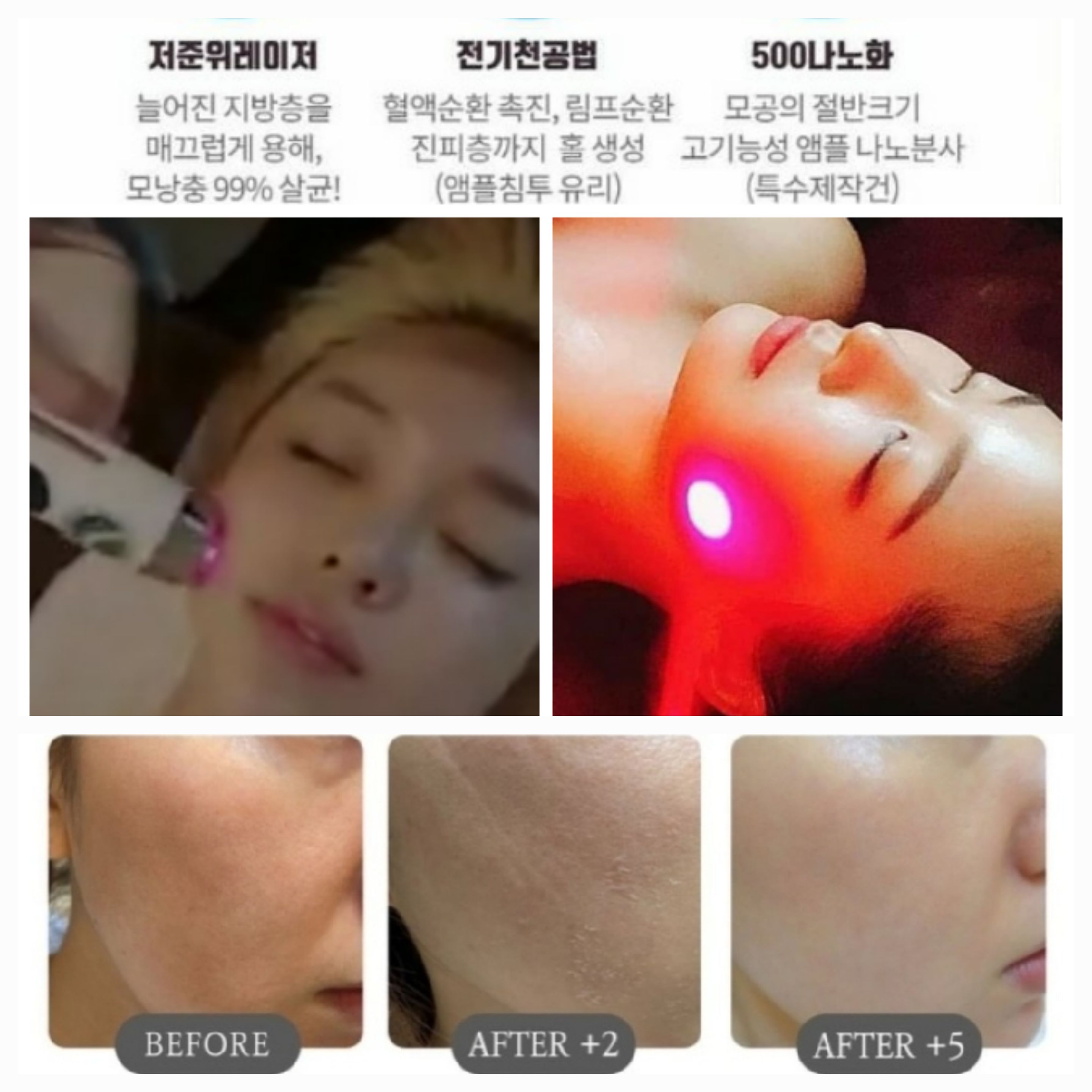 임스테라피 photo 6