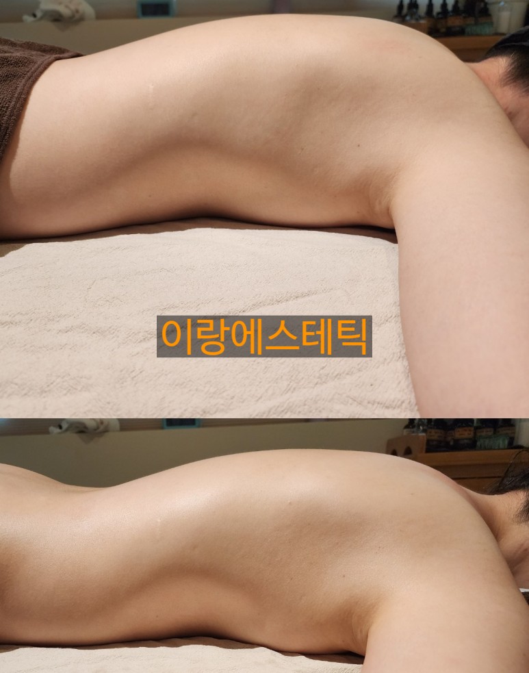 이랑에스테틱 미아본점 대표 이미지