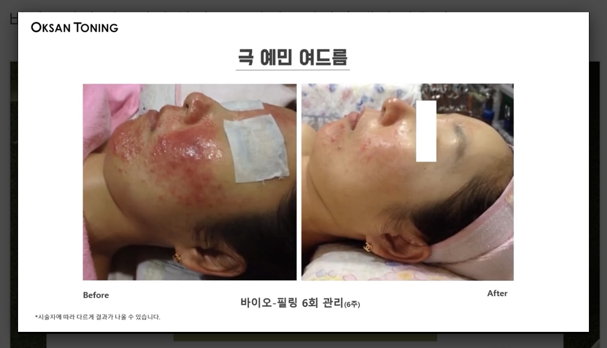 서울에스떼 대표 이미지