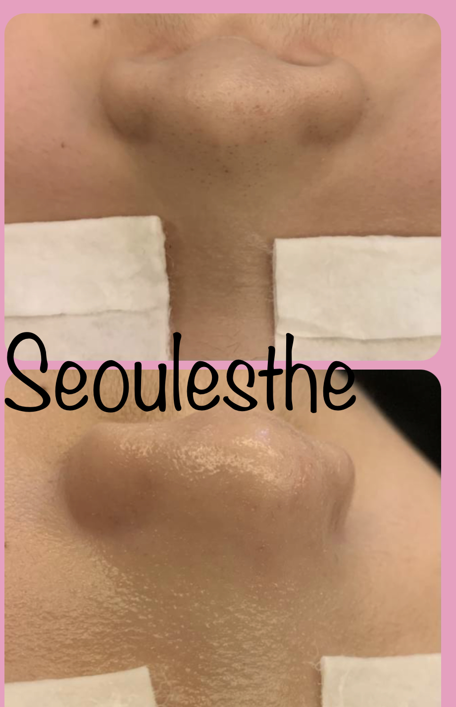 서울에스떼 대표 이미지