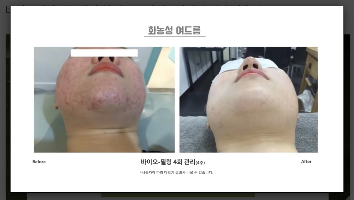 서울에스떼 대표 이미지