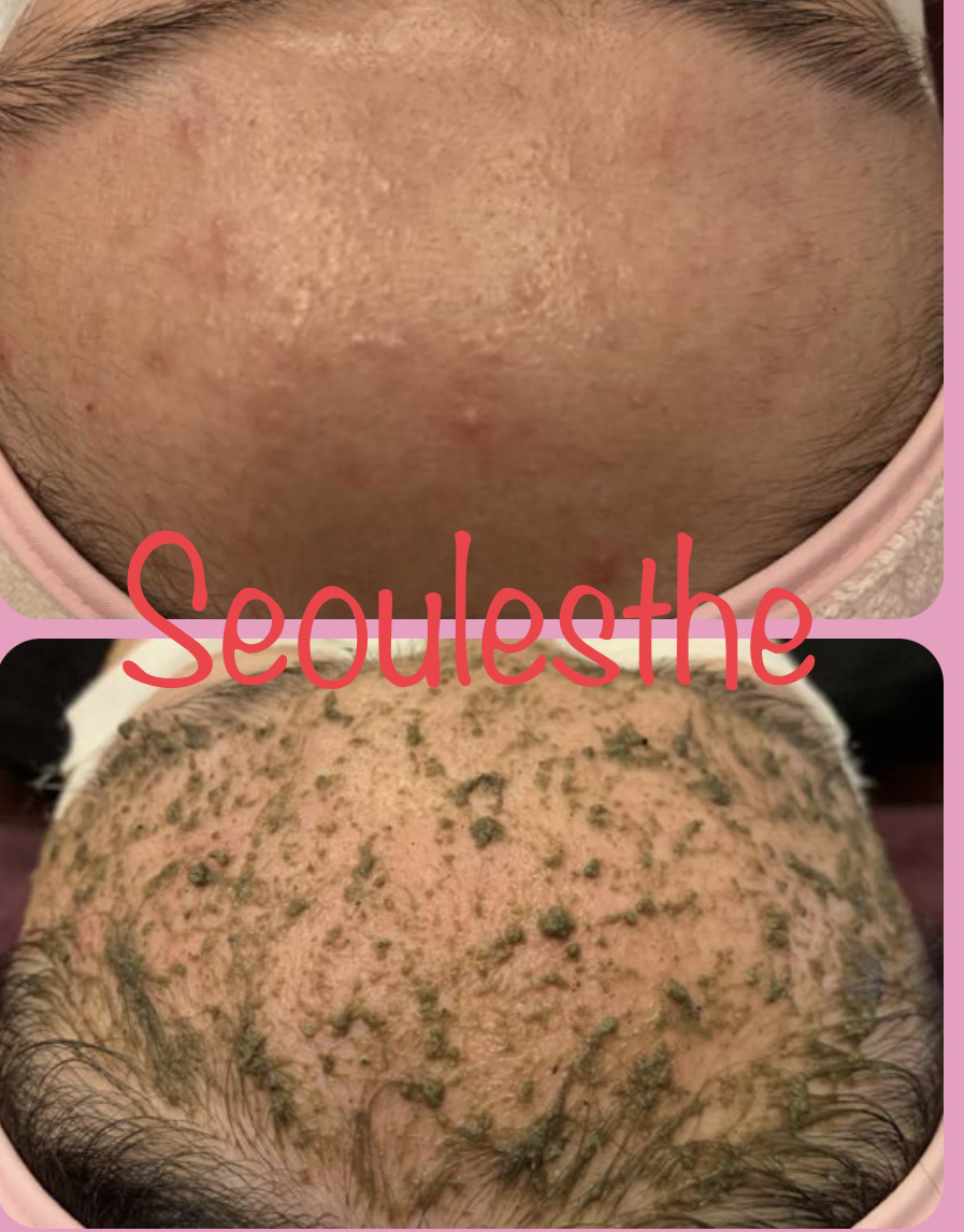 서울에스떼 대표 이미지