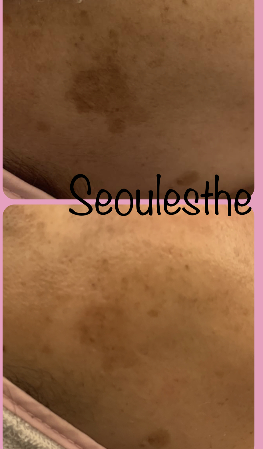 서울에스떼 대표 이미지