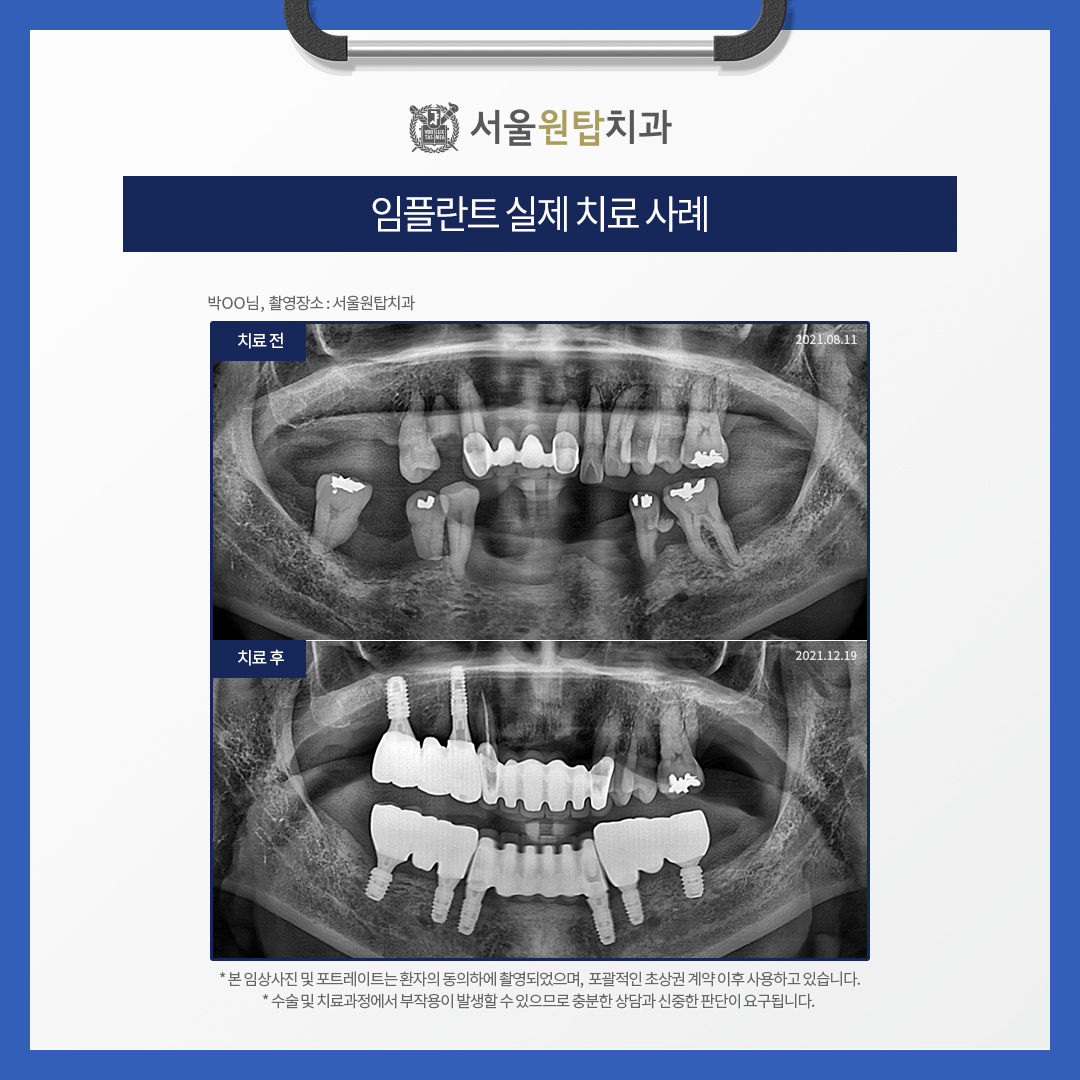 365서울원탑치과의원 대표 이미지
