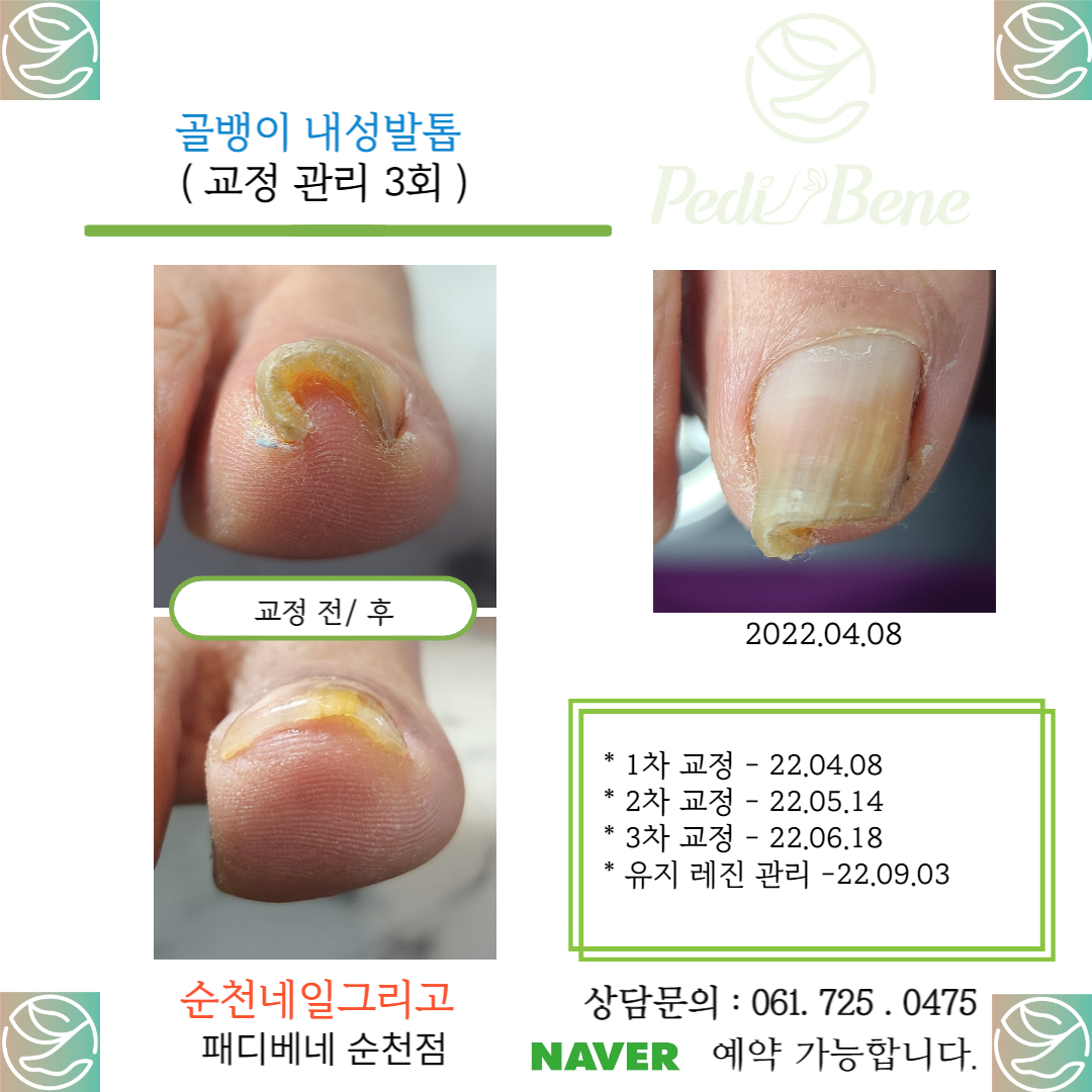 네일그리고