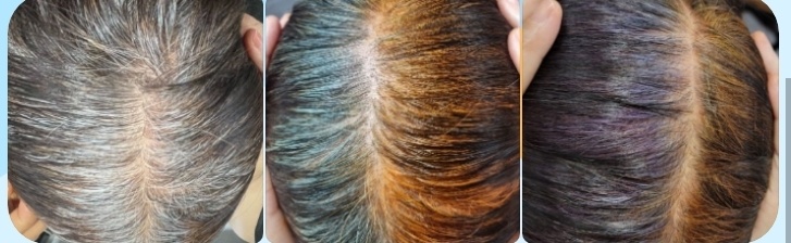 하라힐즈헤나. 탈모관리.두피케어