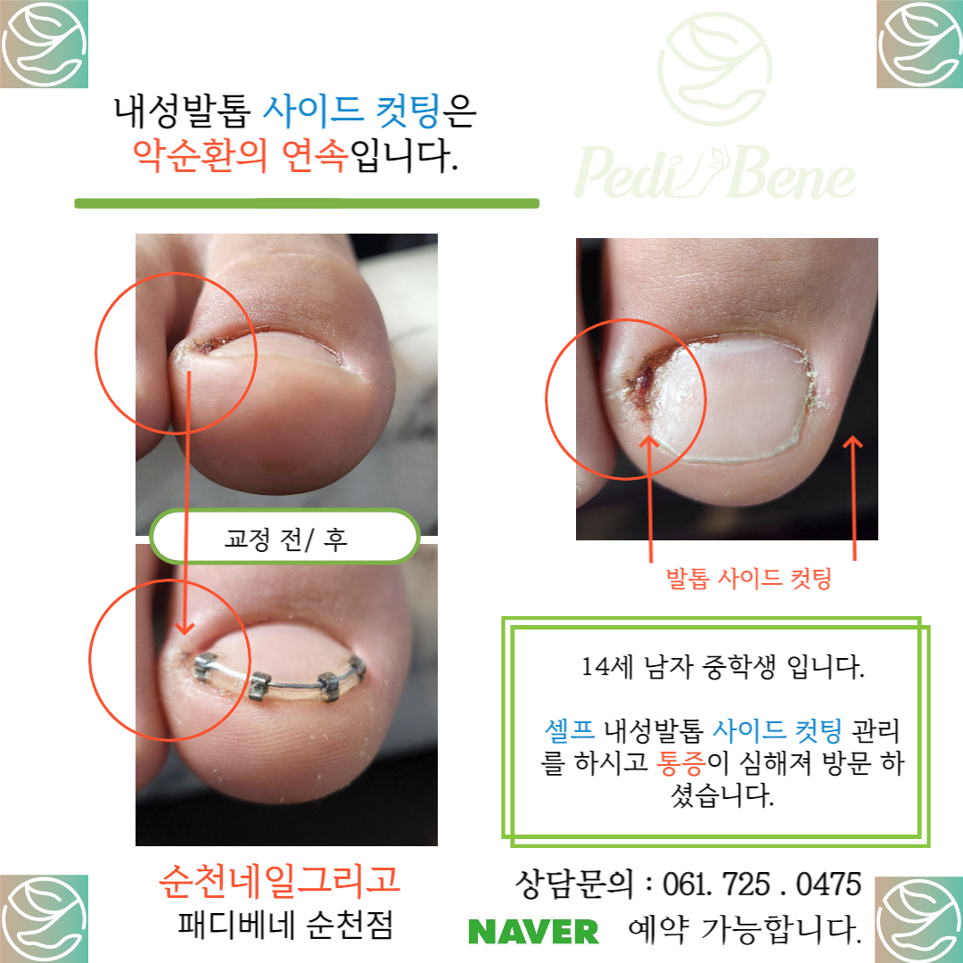 네일그리고