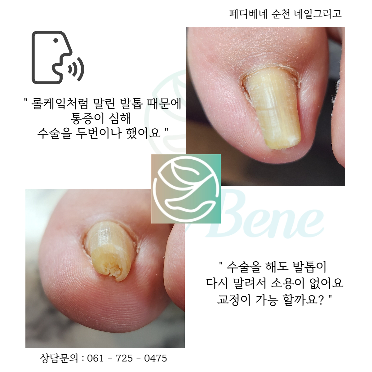 네일그리고