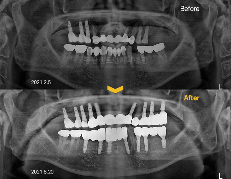 동탄센트럴치과병원 대표 이미지