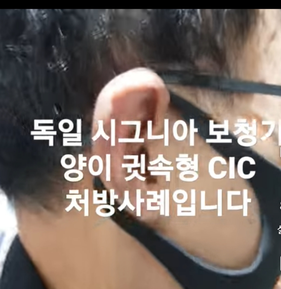 표가네보청기 대표 이미지