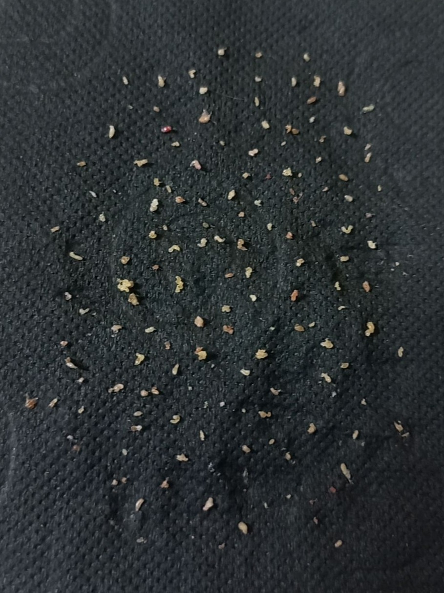 희 에스떼 대표 이미지