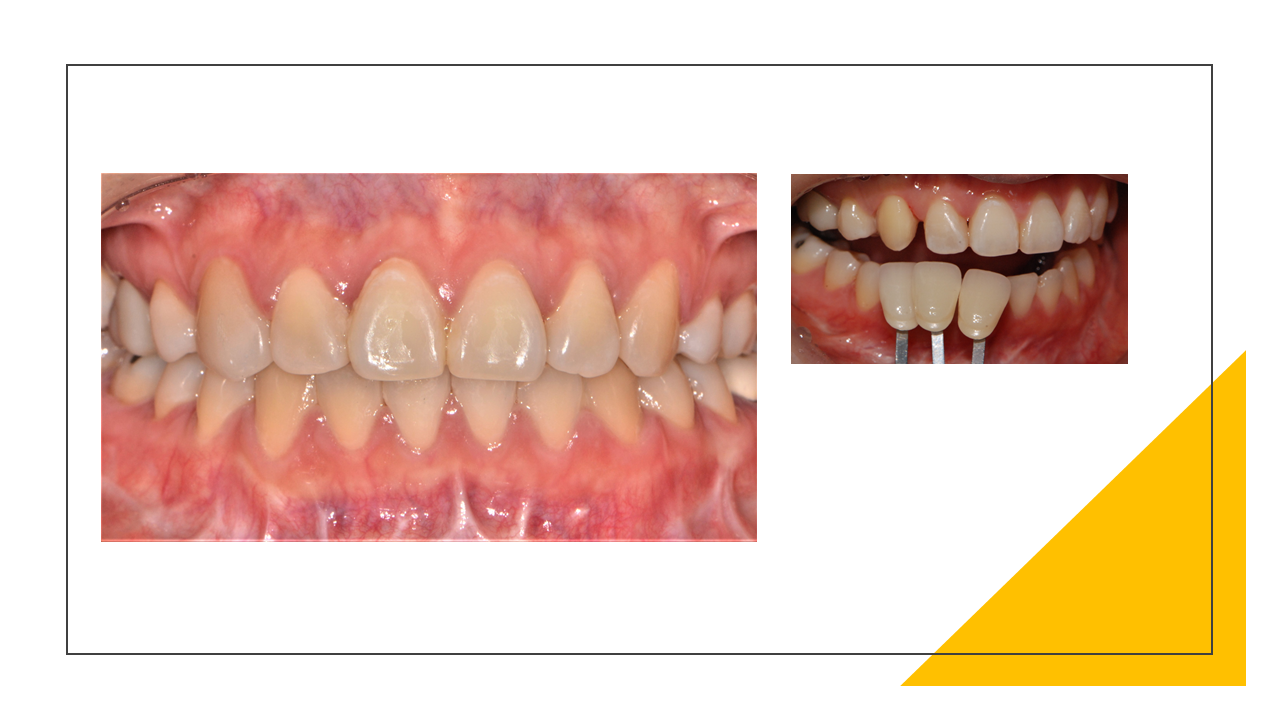 서현치과기공소 대표 이미지