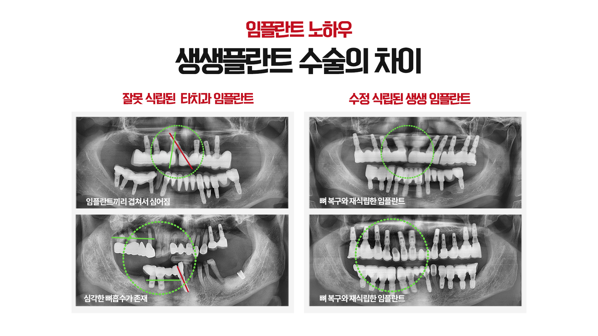 생생플란트 치과의원