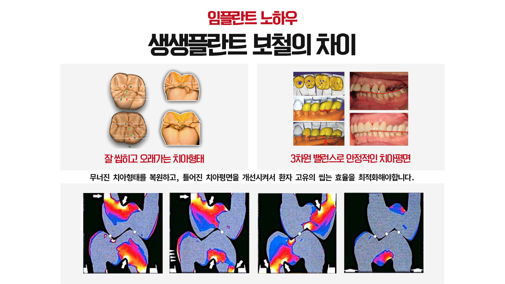 생생플란트 치과의원 대표 이미지