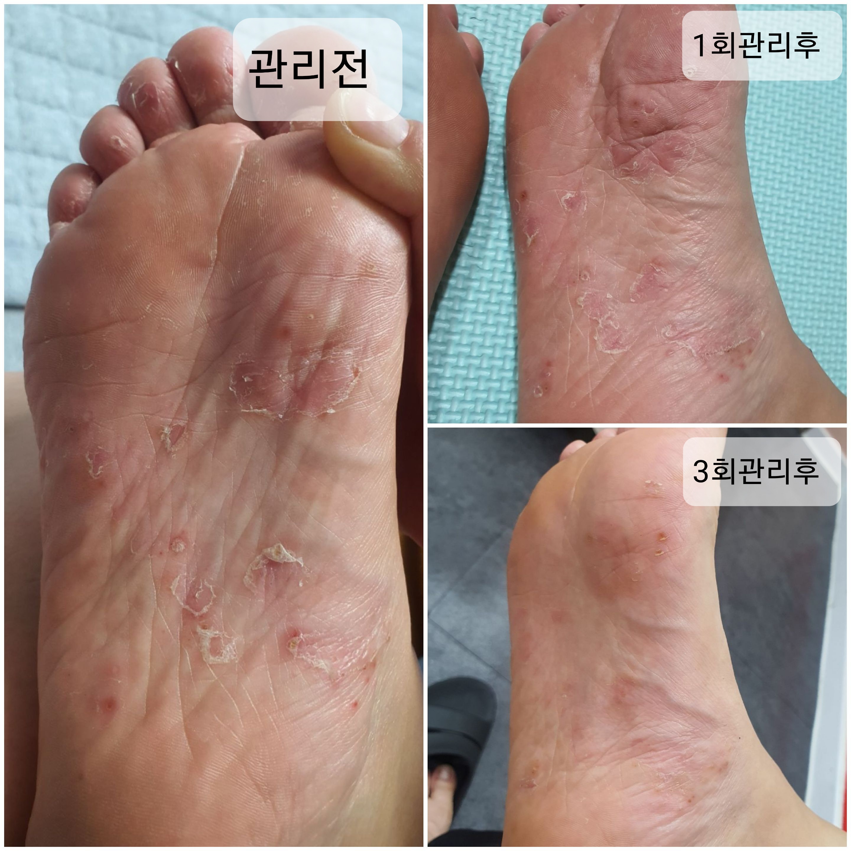 제니스타 힐링포유 원곡지점