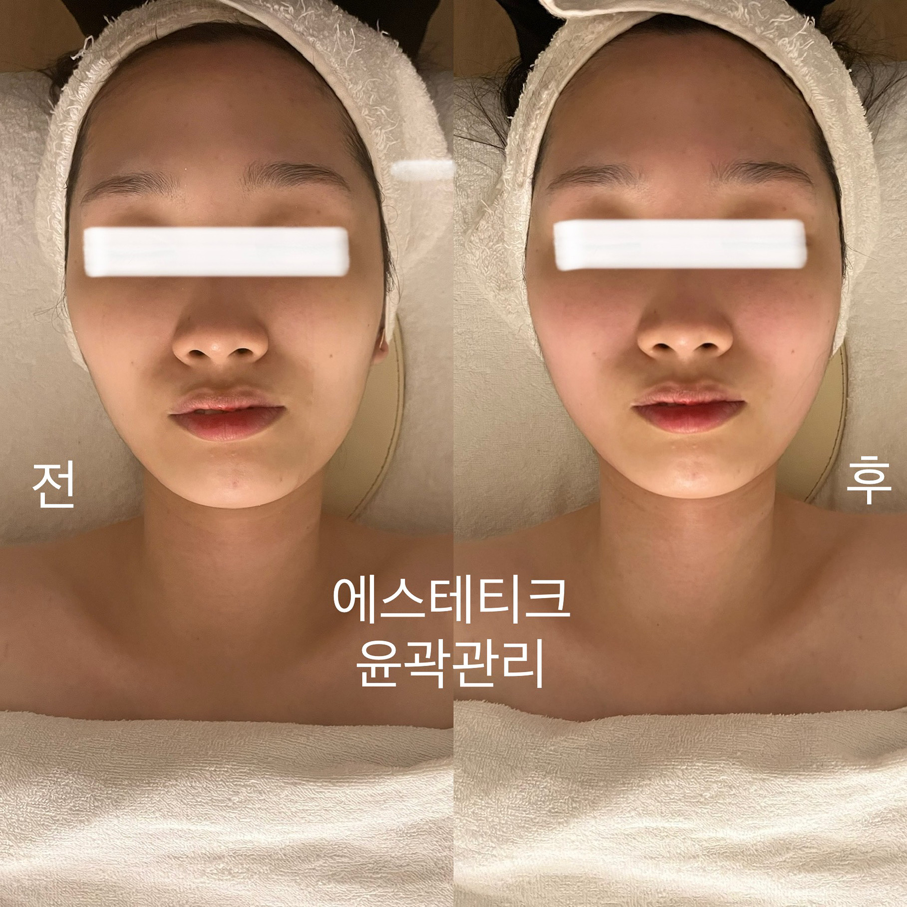 에스테티크 photo 10