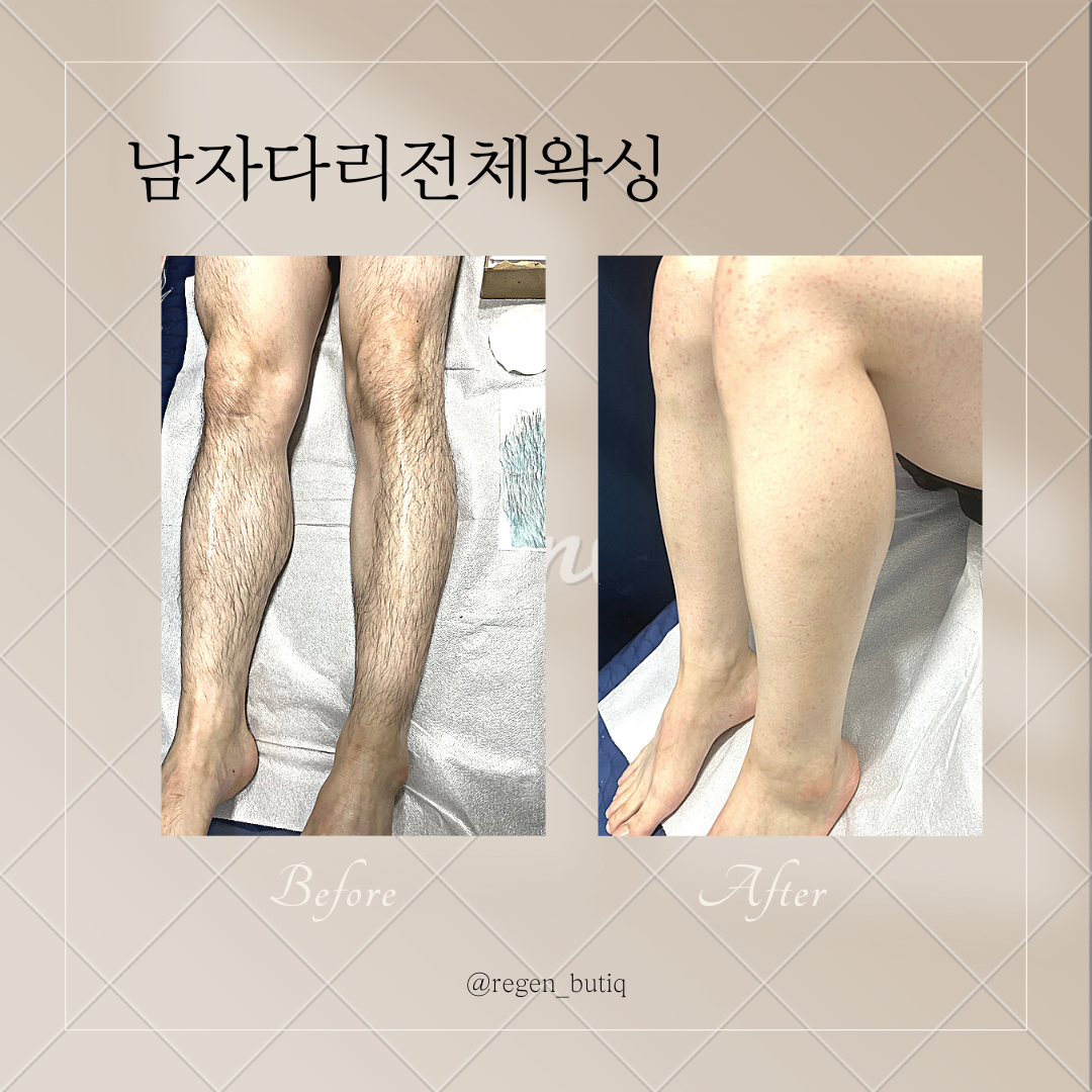 리젠왁싱&스킨케어
