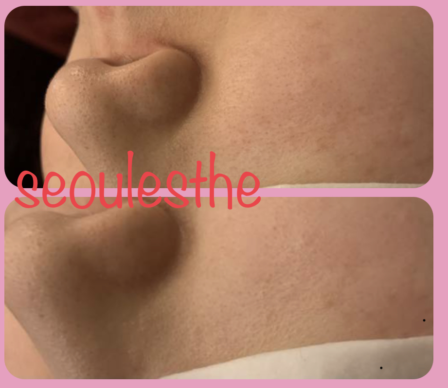 서울에스떼 대표 이미지