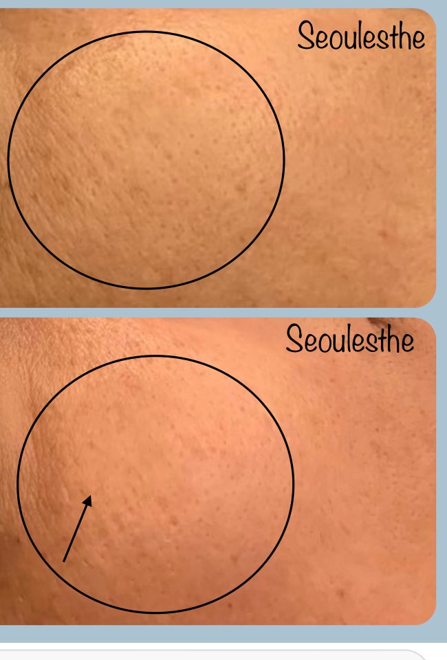 서울에스떼 대표 이미지