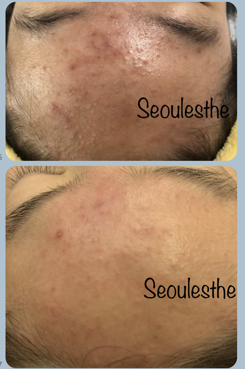 서울에스떼 대표 이미지