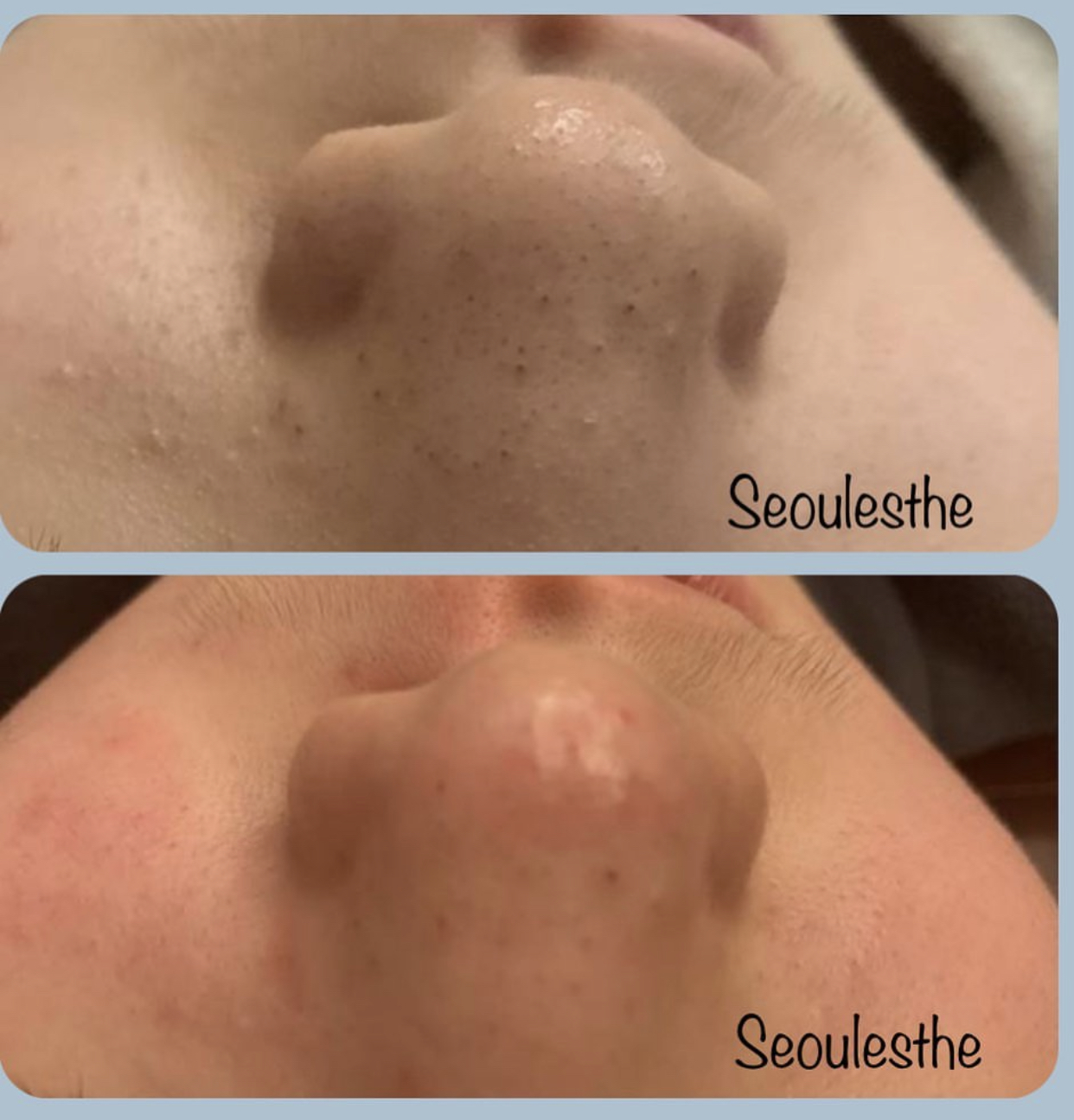 서울에스떼 대표 이미지