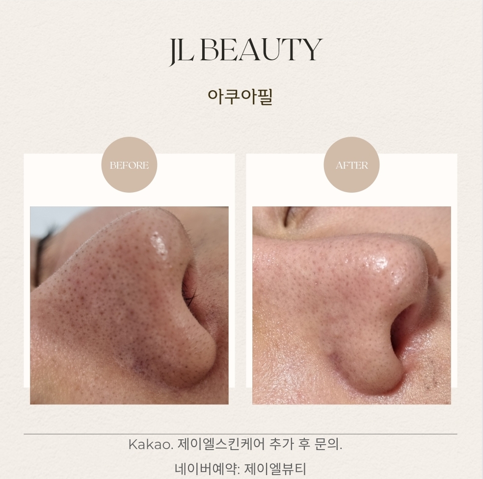 제이엘뷰티