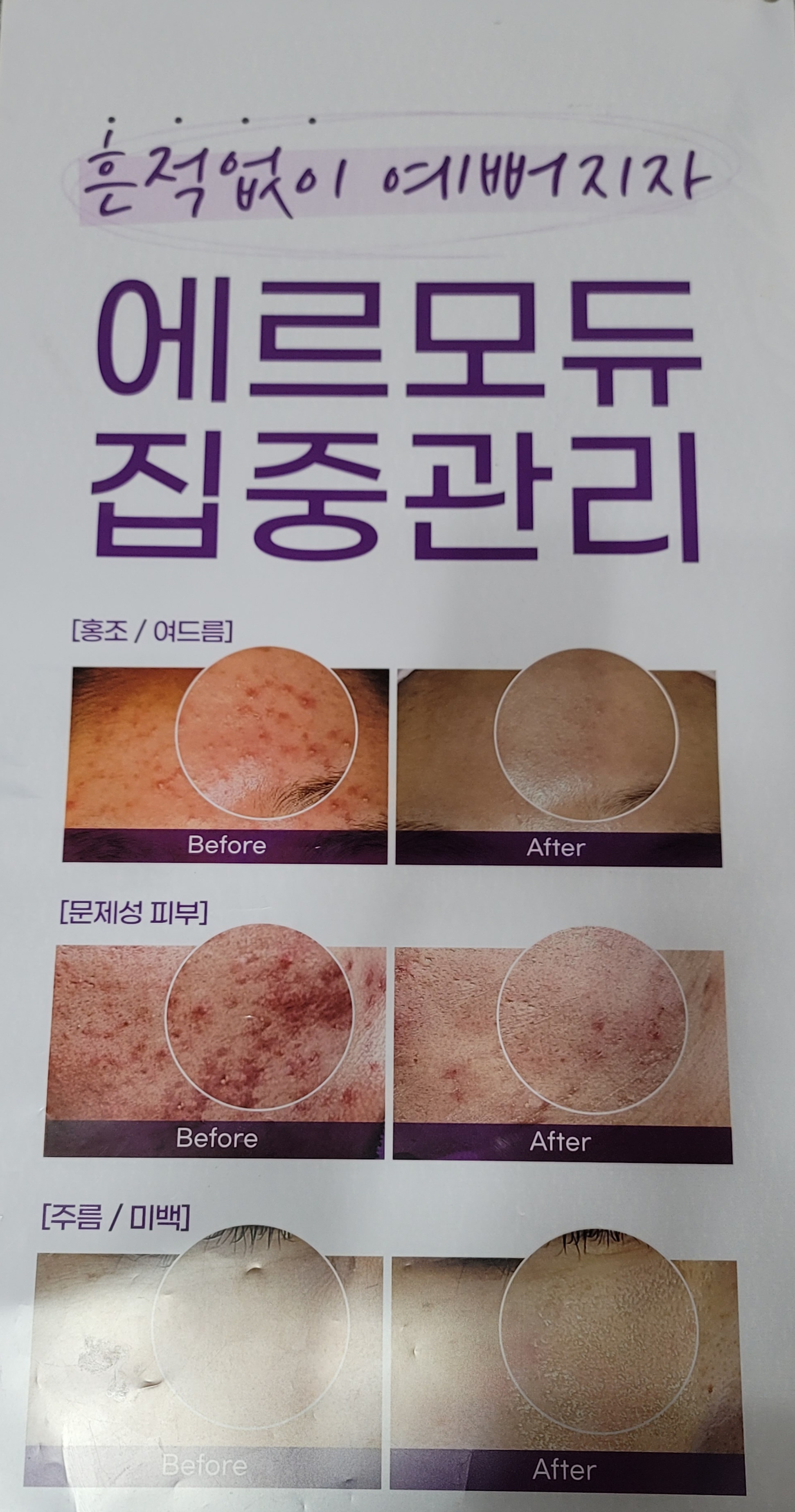 히어로스파내샵 photo 3