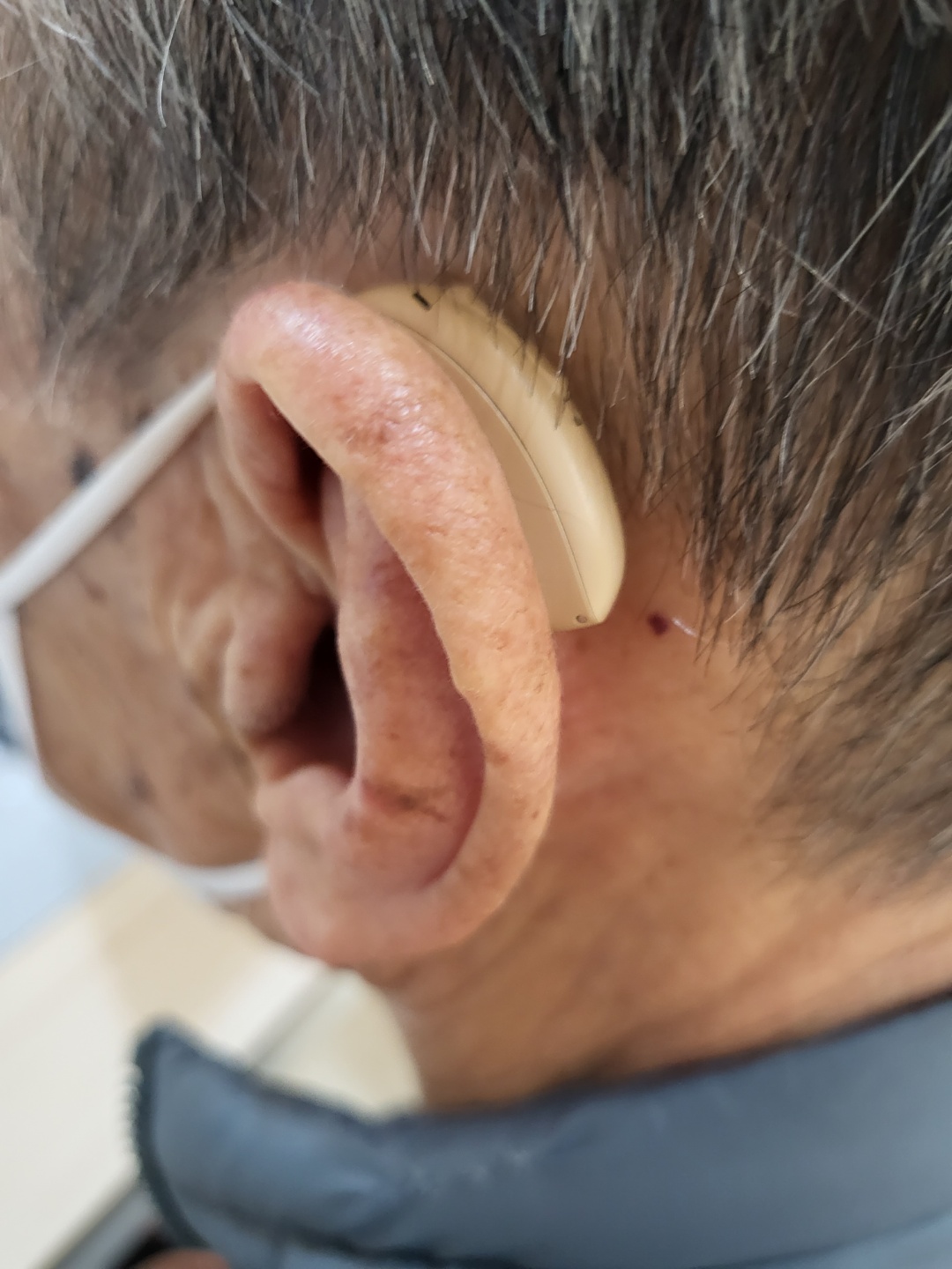 바로난청연구소 언어청각재활센터 대표 이미지