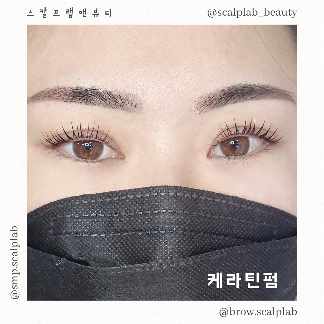스칼프랩앤뷰티