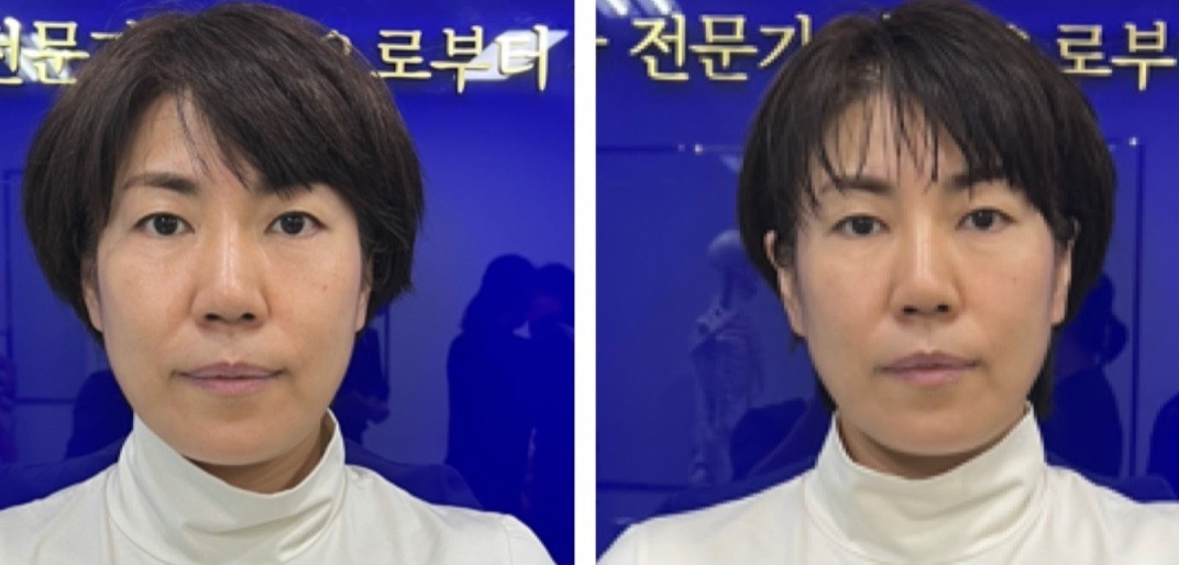 본힐링테라피 이미지