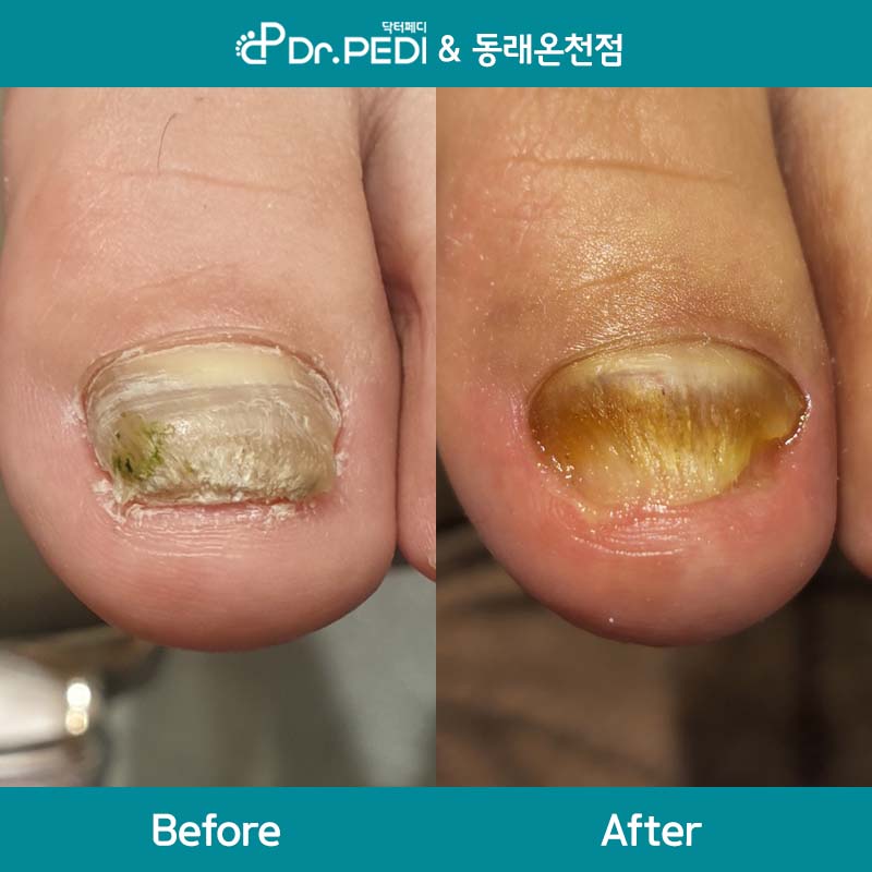 닥터페디 동래온천점