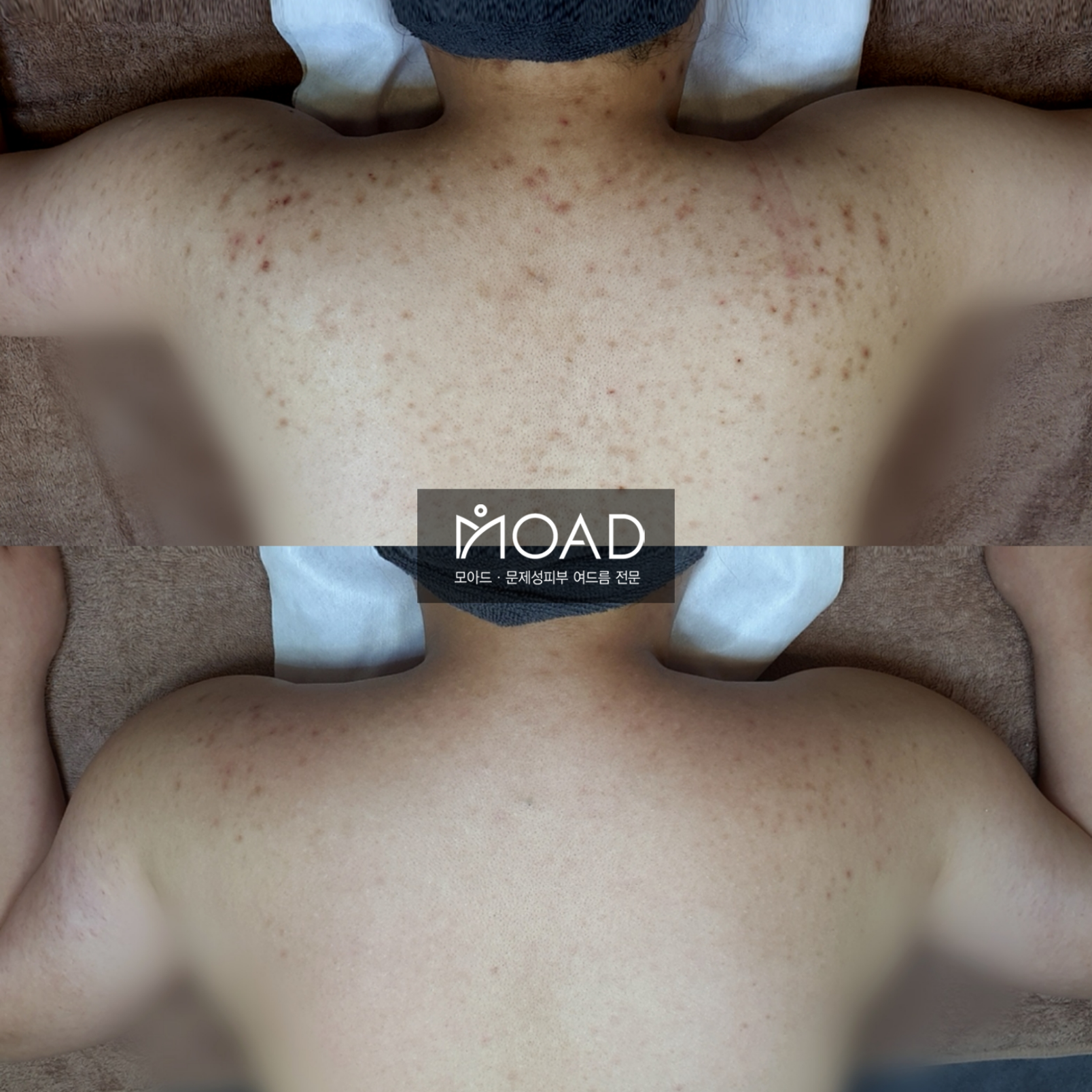 모아드 대표 이미지