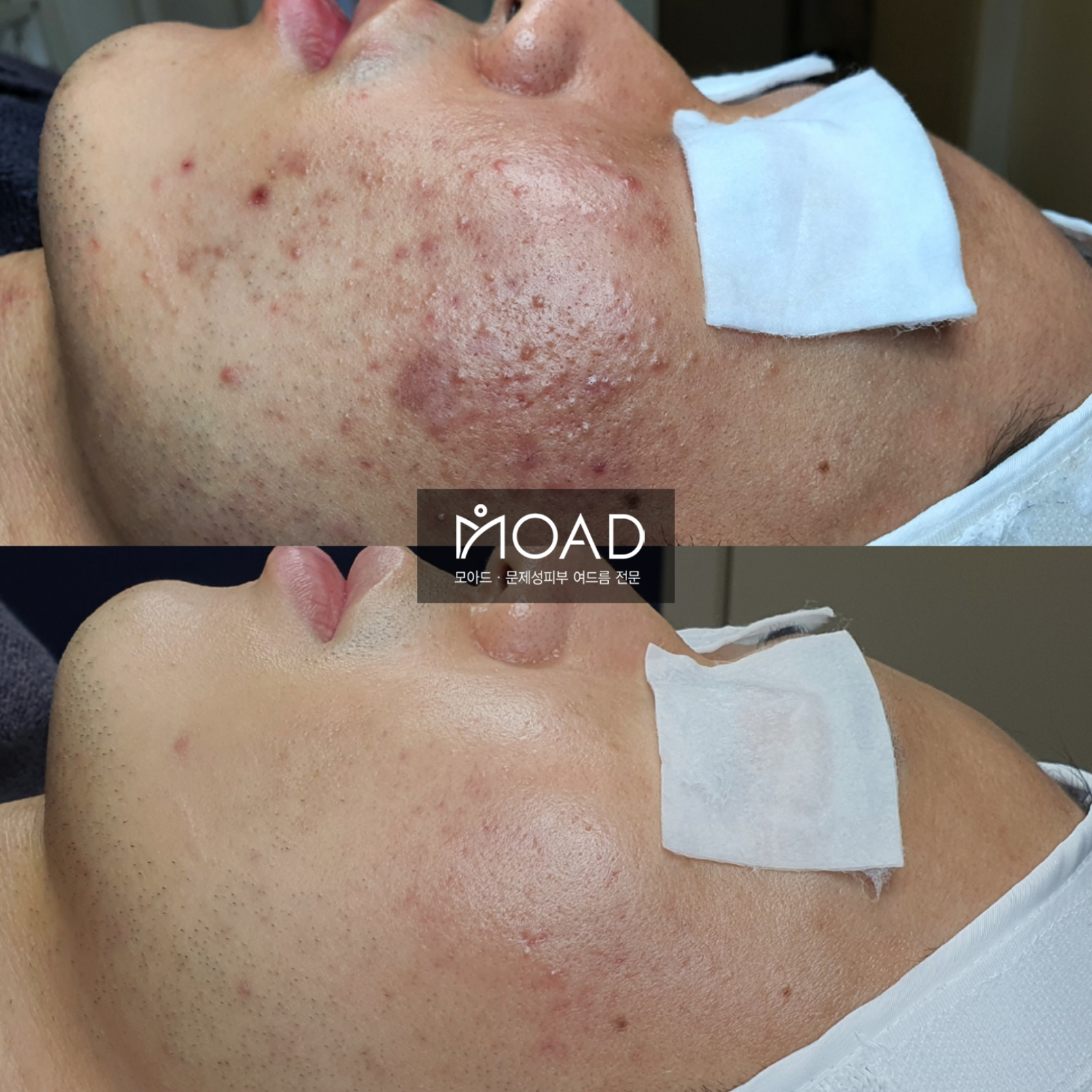 모아드 대표 이미지